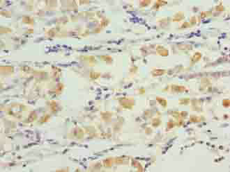 SMG6 Polyclonal Antibody