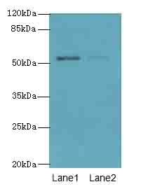 SLC46A3 Polyclonal Antibody