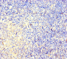 CNGA4 Polyclonal Antibody