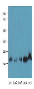NRSN1 Polyclonal Antibody