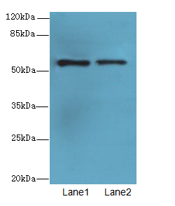 WDR34 Polyclonal Antibody
