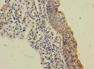 SLC6A15 Polyclonal Antibody
