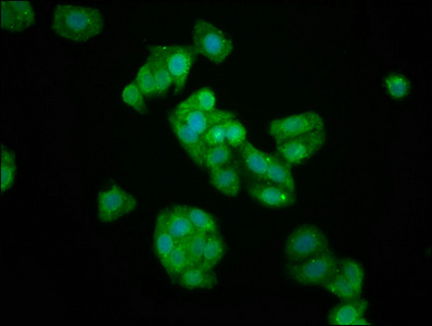 KIFAP3 Polyclonal Antibody