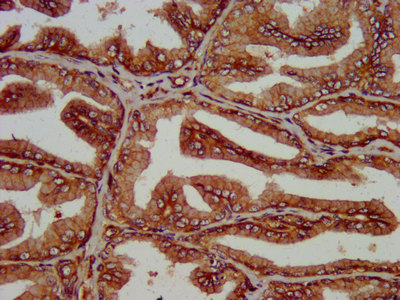 SLC14A1 Polyclonal Antibody