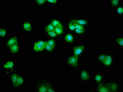 CHMP1A Polyclonal Antibody