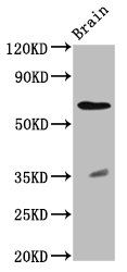 RPE65 Polyclonal Antibody