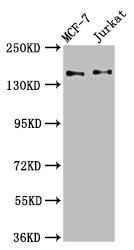 KTN1 Polyclonal Antibody