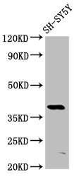 MKX Polyclonal Antibody